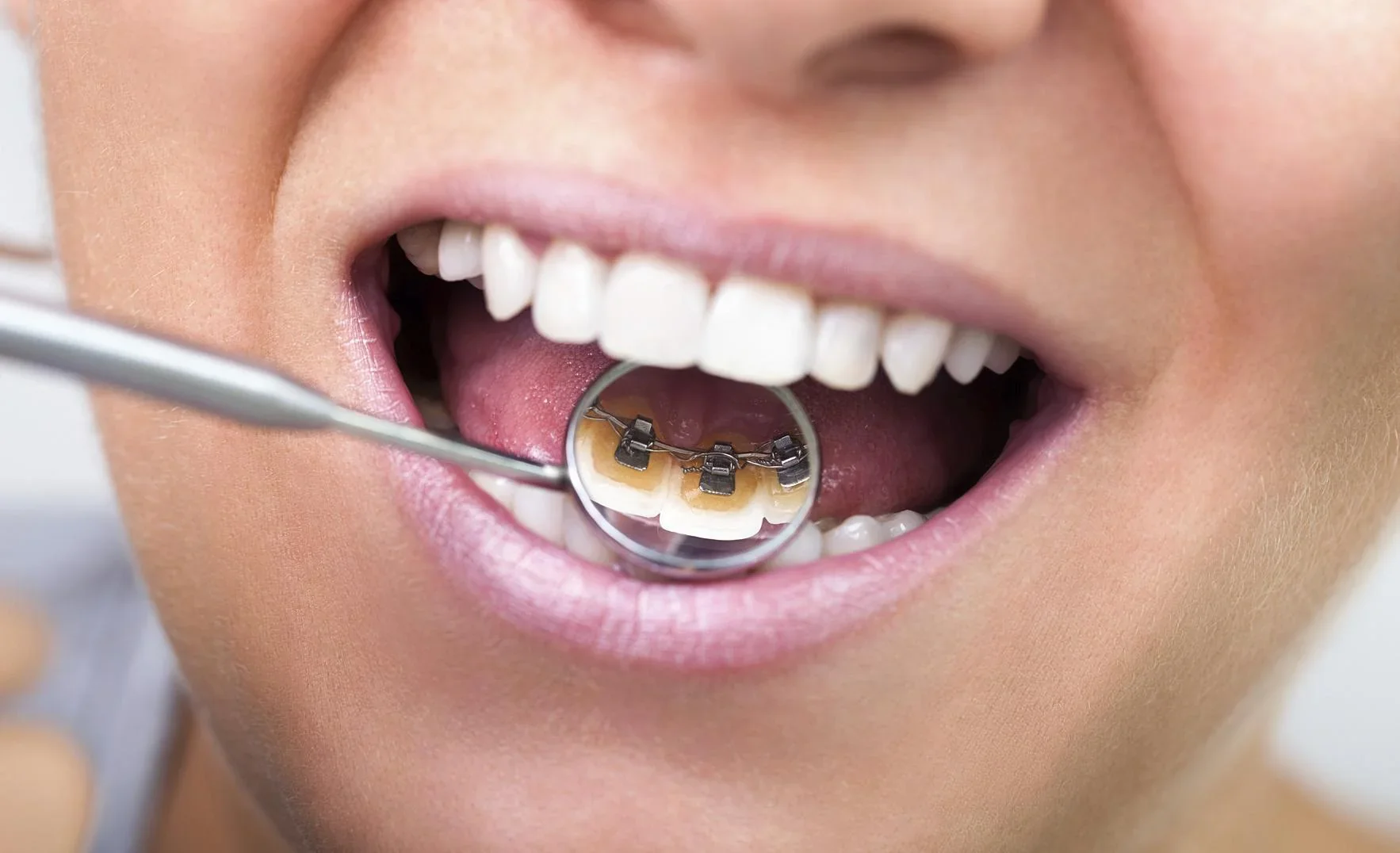 Zahnpflege-Set "Dental" - 0
