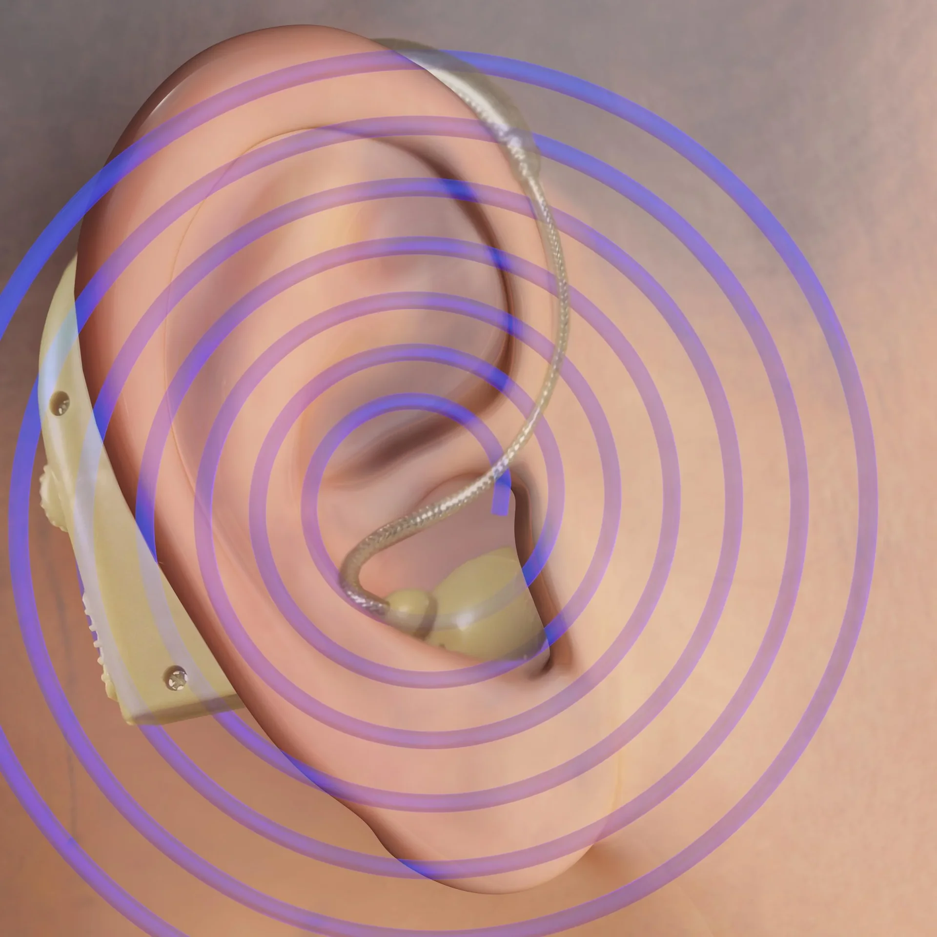 Hörverstärker "Sound Genie", 1 Stück - 0