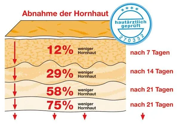 Hornhaut-Balsam, 30 ml - 5