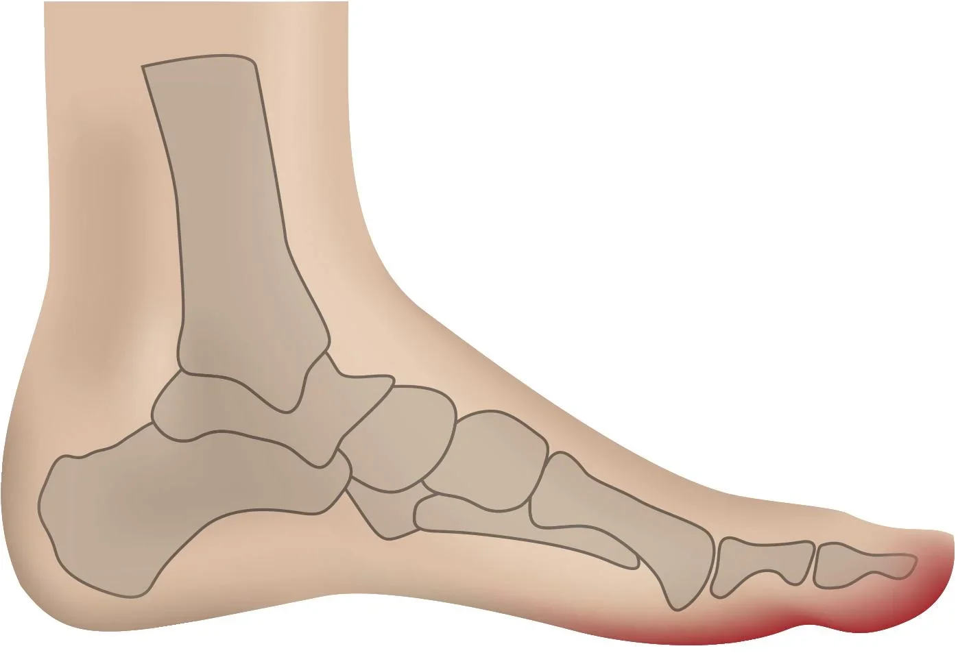 Polsterkappe, mit Silber, universal, Beige, 1 Paar - 0