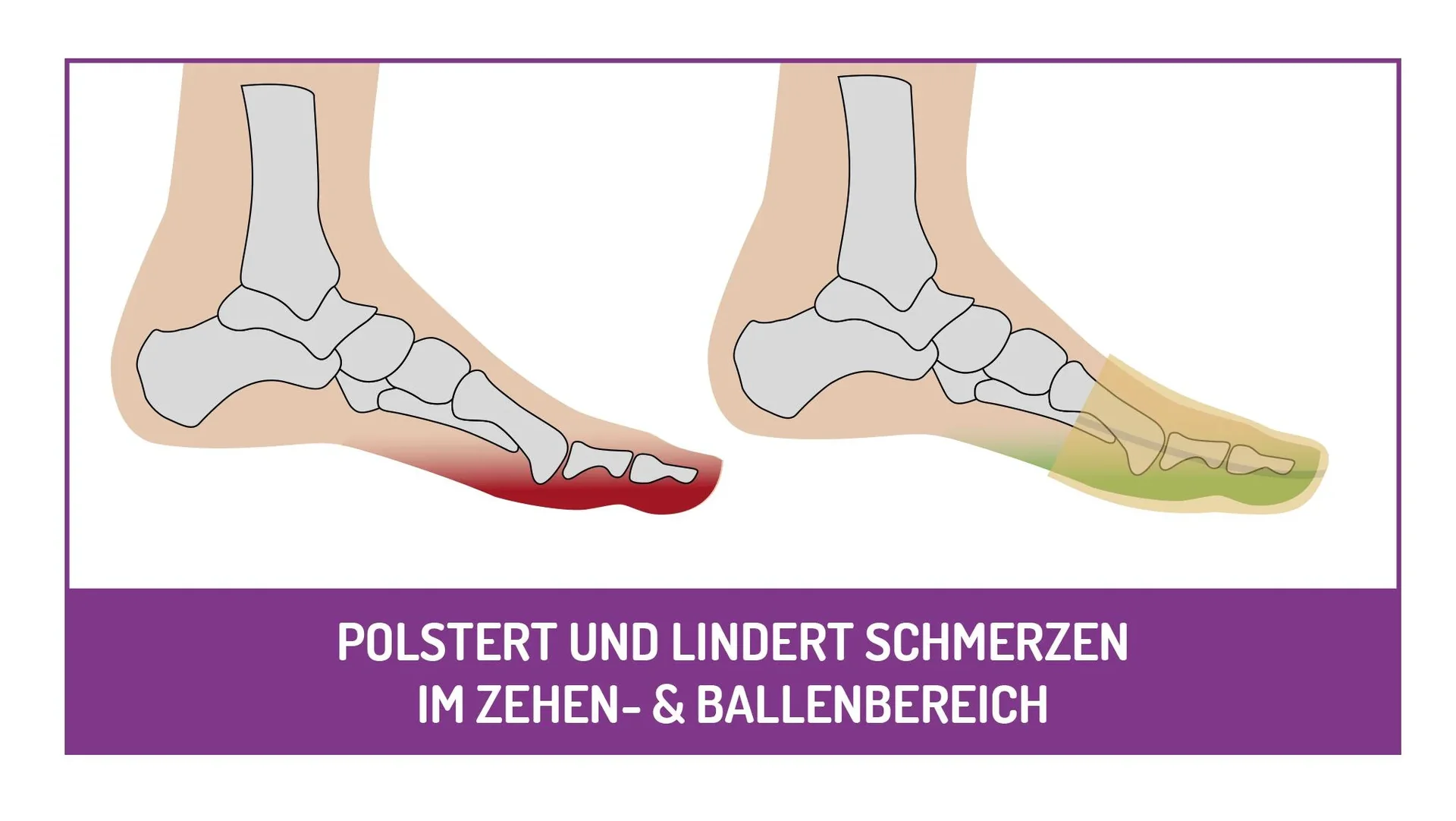 Polsterkappe, mit Silber, universal, Beige, 1 Paar - 3