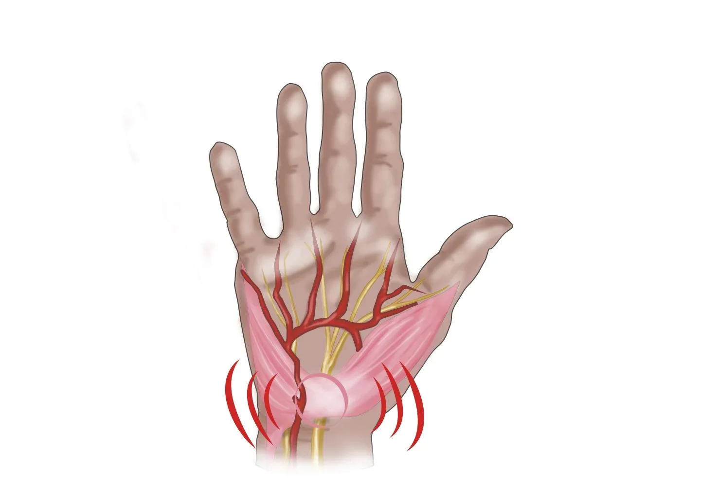 Handgelenkbandage bei Athrose und Karpaltunnel, links, 1 Stück - 1