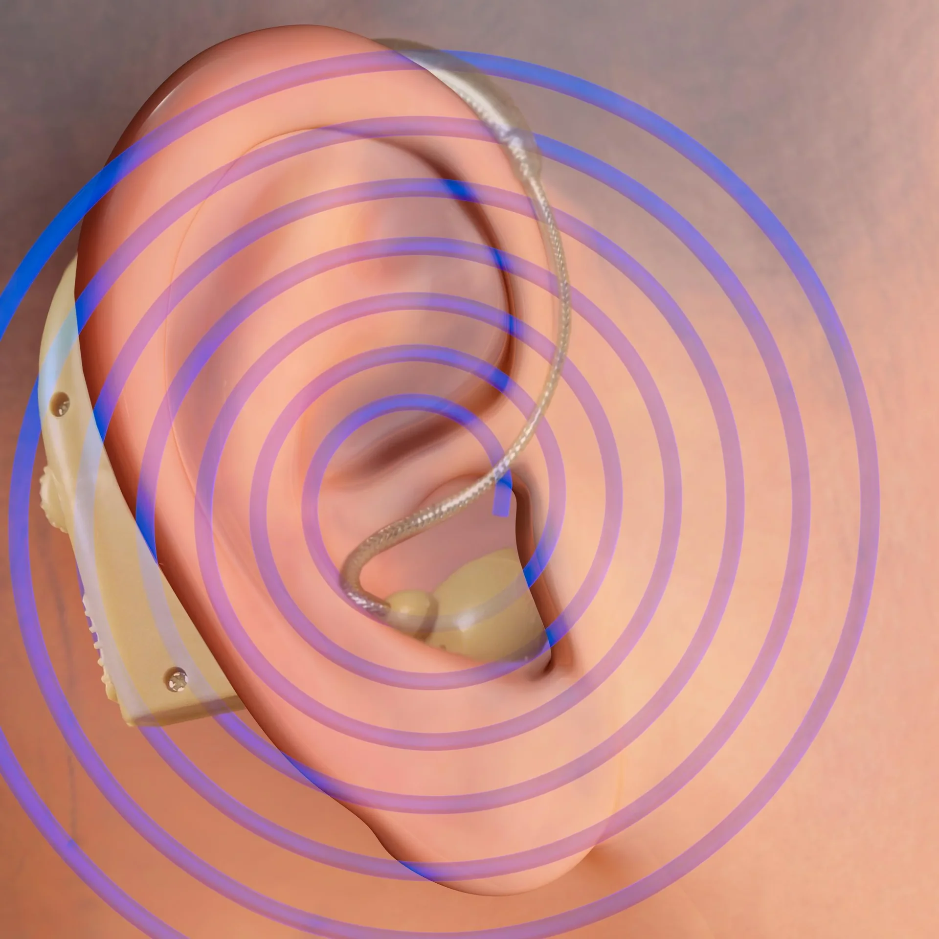 Hörverstärker "Sound Genie", 2 Stück - 0