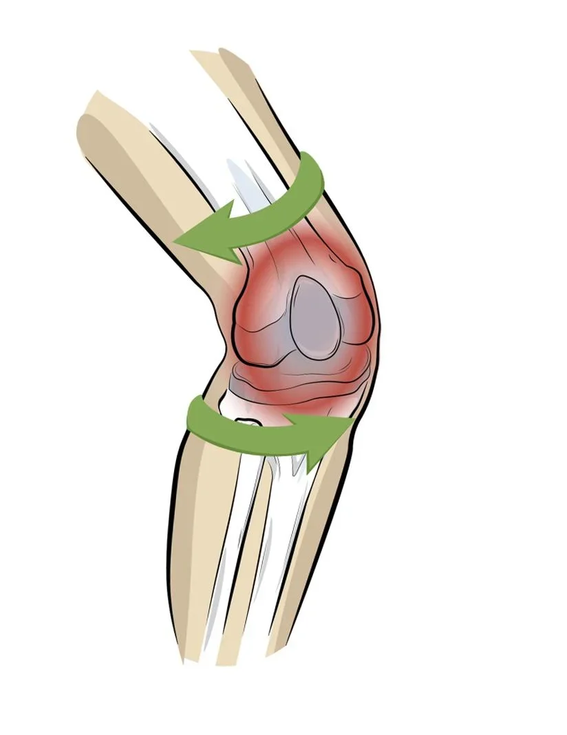 Kniebandage PatellaTec, Größe XL - 3