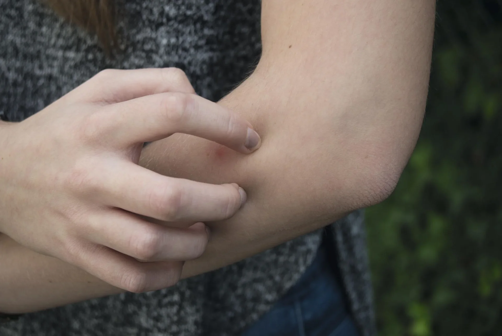 Stechmücken-Feind - 4