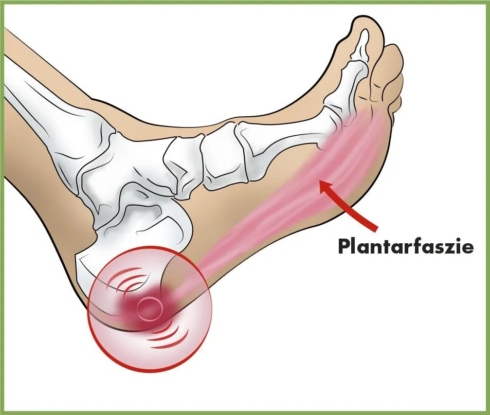 Faszien-Fußroller - 3