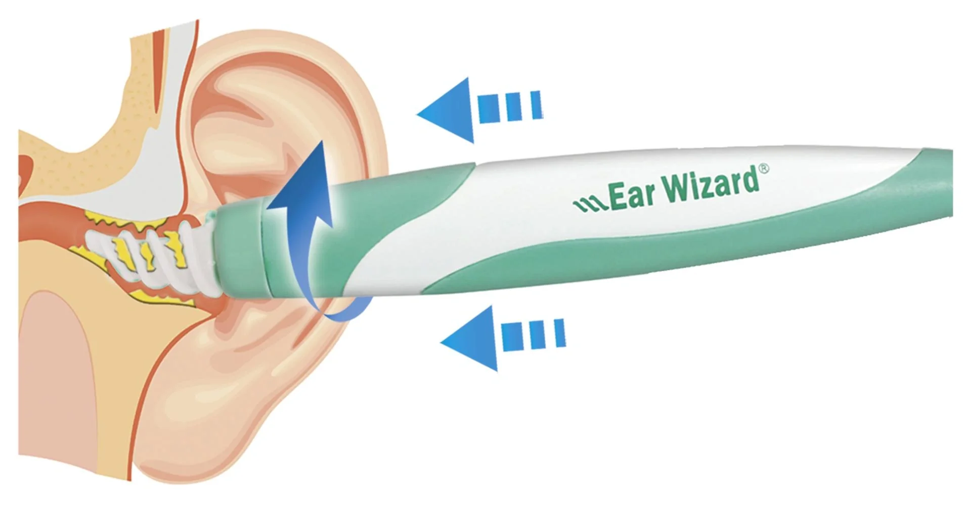 Ohrenreiniger-Set „Ear Wizard“, mit 15 Silikonaufsätzen und Aufbewahrungsbox, 17-teilig - 10