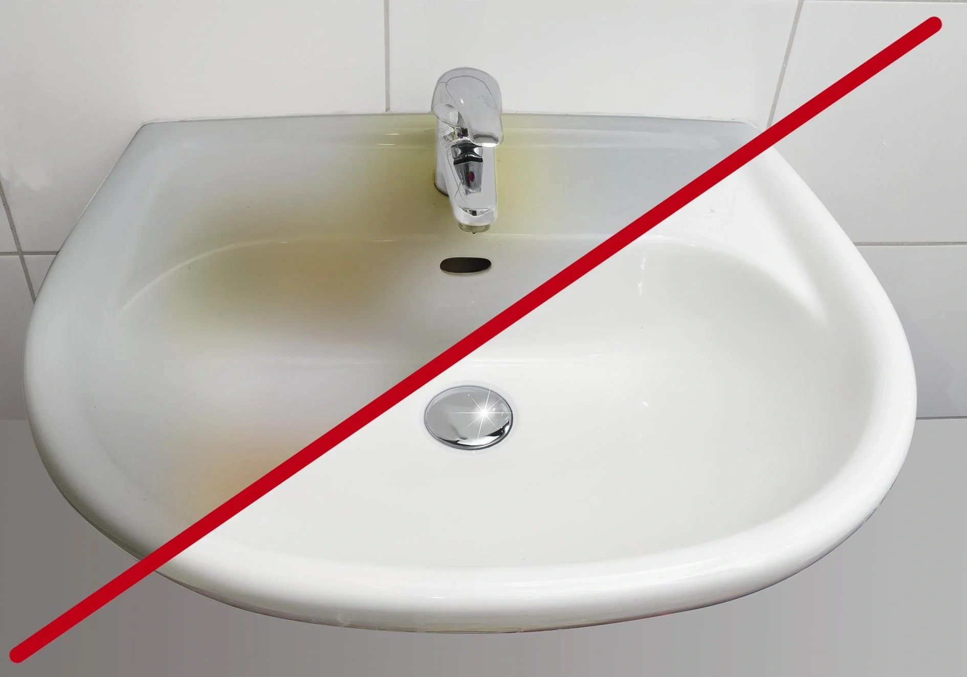 Abperl-Fix Reinigerset, 7-teilig - 12