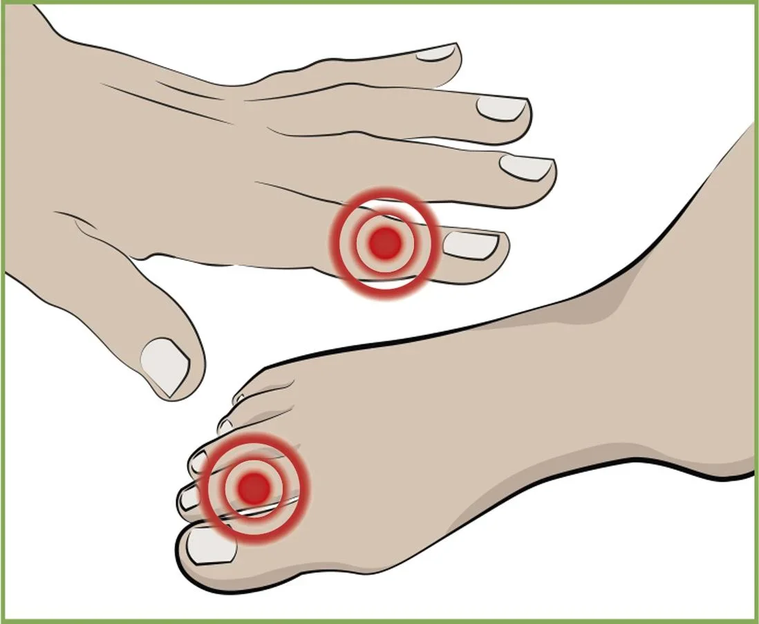 Finger- und Zehenschutz, je 2 Stück - 2