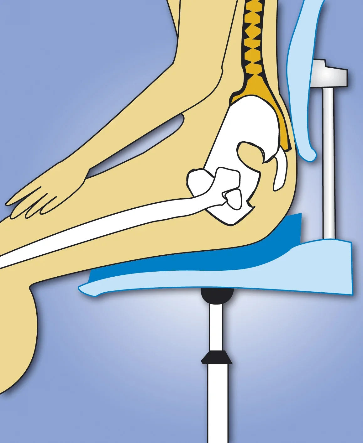 Auto-Sitzkissen Keil mit Bezug, blau - 0