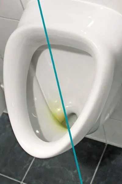 WC Hai, 500 ml - Urinsteinlöser Konzentrat -